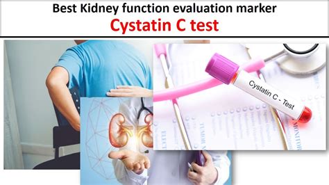 Labcorp cystatin c. Things To Know About Labcorp cystatin c. 